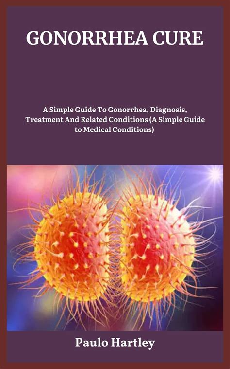 Gonorrhea guide: Treatment and follow.